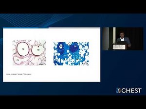 A systematic approach to bronchiolitis or bronchiolar disorders