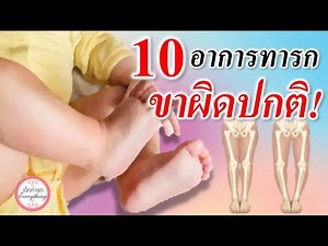 อาการทารก : 10 อาการขาทารกผิดปกติ! | ขาเด็กทารก | เด็กทารก Everything