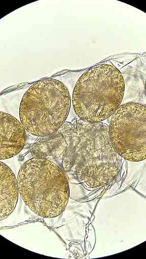 Water Bears Hatching Under the Microscope