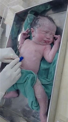 Just delivery newborn cord clamp process #cutebaby #newbornbaby #youtubeshorts #viralvideo