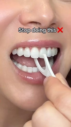 Dr. Joyce Kahng | Cosmetic Dentist OC Veneers on Instagram: "🧵How to *properly* floss - FLOSS PICK edition. Just like with string floss, the goal is to adapt the flosspick string around the curve of the tooth and to create a “C shape”. Creating a C shape with string floss is much easier than with the floss picks. This is why string floss is >>>>> However, with intention it is possible to use floss picks. Remember: 1 contact, 2 teeth, NO bluhdddd 🩸 ❗️If you want to see what this looks like with