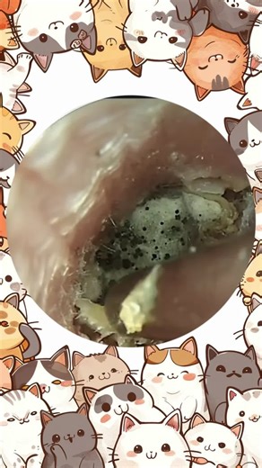 SeeClear EarDigger on TikTok