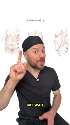 The most popular body-lift procedure?