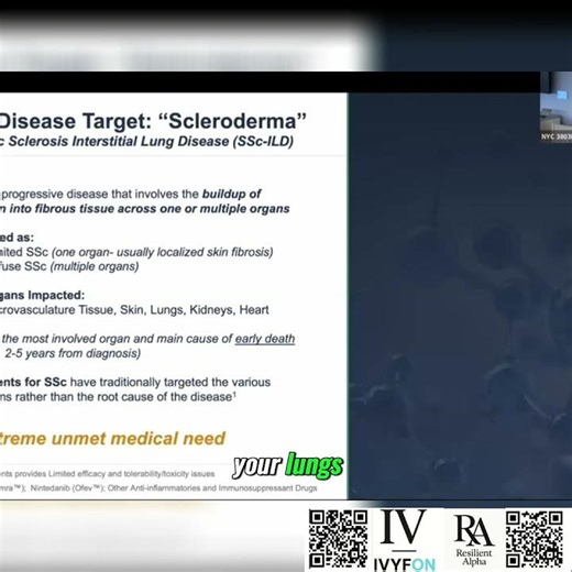 Resilient Alpha Understanding Diffused Disease_ Key Organs & Symptoms | Diffused Disease 🧬#health