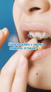 💋 ¿Brackets y besos? Sí se puede con este truco 👀✨ Sabemos que si usas brackets, las rosaduras pueden ser incómoda... ¡Pero no tienen que arruinar tus momentos románticos! 💙✨ Usa cera ortodóntica para proteger tus labios y disfrutar de cada beso sin preocupaciones. Visita Multident Lince @multident.lince_oficial 📍Visítanos en Av. César Vallejo 1560, Lince (a 4 cuadras del Real Plaza Salaverry) #dentista #clinicadental #odontologia #dientessanos #multident #bracketsmetalicos #bracketsestetico