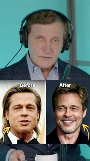 Facial Surgeons ™ on Instagram: "Chasing “pretty” is easy — but creating true beauty takes balance, harmony, and longevity. That is the real art of @rod.rohrich. In this episode, he breaks down why great facial results are never about one feature, but about how every element works together: eyes, nose, lips, jawline, skin, and underlying structure. Overdone is done. Natural doesn’t mean doing less; it means doing what’s right — with precision, restraint, and deep respect for anatomy. For patient