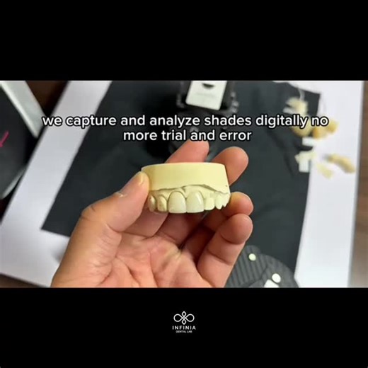 Shade matching isn’t guesswork anymore — it’s science. With eLab, we capture, analyze, and recreate natural tooth color digitally — making veneers that fit and match perfectly before the patient even arrives. #digitaldentistry #dentallab #shadematching #veneers #smiledesign #dentalinnovation #infiniadentallab | Infinia Dental Lab