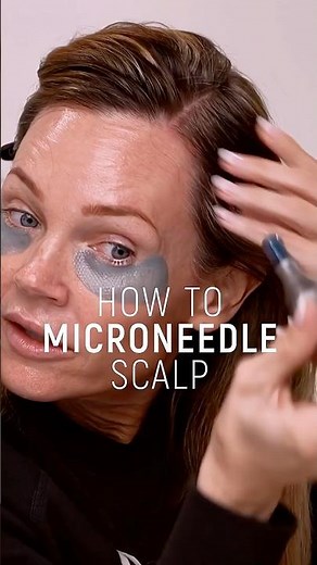 Microneedle your scalp for more hair