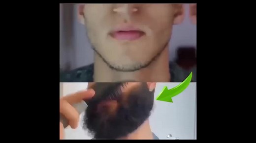 JAYSUING Hair Treatment Spray for Hair Growth and Hair Loss Treatment