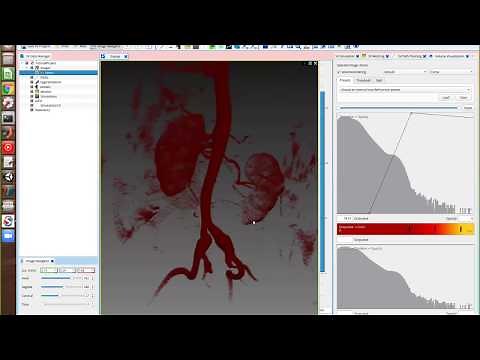 Simvascular Tutorial 1: Loading and Manipulating Image Data