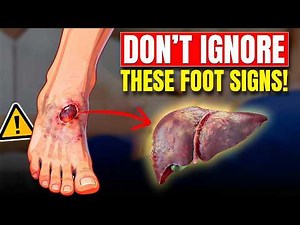 14 Warning Signs of Liver Disease in Your Feet & Legs (And What to Do Right Now)