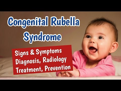 Congenital Rubella Syndrome (CRS) Symptoms, Diagnosis and Treatment | TORCH Infections