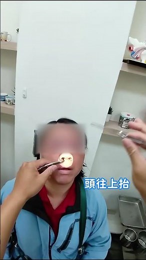 鼻塞術後最期待的時刻就是拿出這條!#鼻塞怎麼辦 #亮宇醫師告訴你#陳亮宇醫師 #陳亮宇耳鼻喉科 #健康 #台中耳鼻喉科 #耳鼻喉科 #過敏 #鼻塞 #鼻過敏 #微創手術 #fpyシ #fpy