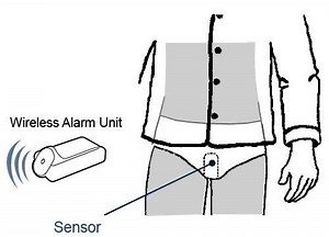 Bedwetting alarm - Alchetron, The Free Social Encyclopedia