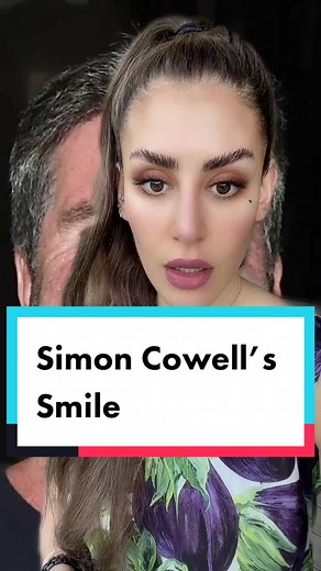 Understanding Smile Design: Techniques for Perfect Teeth