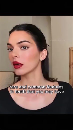 Rare and Common Features of Teeth Explained