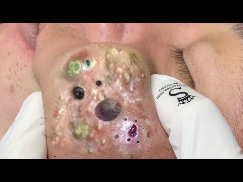 𝑅𝑒𝑐𝑙𝑎𝑖𝑚 𝑌𝑜𝑢𝑟 𝐺𝑙𝑜𝑤 𝐴𝑛𝑑 𝐶𝑎𝑙𝑚 𝑇ℎ𝑟𝑜𝑢𝑔ℎ 𝑀𝑖𝑛𝑑𝑓𝑢𝑙 𝑆𝑘𝑖𝑛𝑐𝑎𝑟𝑒 𝑀𝑜𝑚𝑒𝑛𝑡𝑠 #5759293