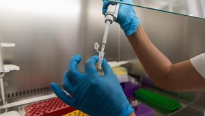 Sangamo stock plummets 50% after Pfizer ends gene therapy deal