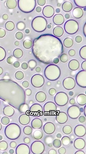Walt on Instagram: "Raw cows milk VS human breast milk - under the microscope! I previously compared pasteurised milk (heat treated milk) with human breast milk - not an unreasonable comparison, given that pasteurised cows milk is the most common accessible type of cows milk for many. But many of you asked me to compare with raw cows milk - and I was fortunate enough to find some tucked away in a tiny corner of my local supermarket. This was a great suggestion! Raw cows milk is not something tha