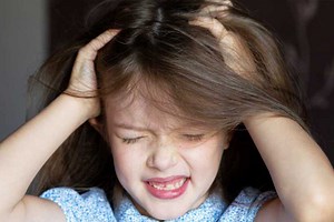 Les poux sont résistants mais ce scientifique dévoile comment s'en débarrasser rapidement