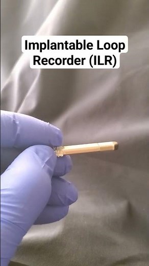 An Implantable Loop Recorder is designed for long term electrical monitoring of the ECG