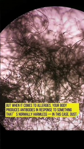 Accumulated dust under the microscope #laboratory #microscope #allergy #dust #antibody #mls #facts