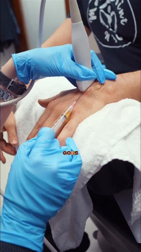 Precision Care Medical&Sports Performance on Instagram: "Intense gym training places repeated stress on the wrist through pressing, pulling, and heavy gripping. Over time, this overload can lead to inflammation and fluid accumulation, restricting movement and reducing strength. Wrist aspiration helps decrease pressure by safely removing excess fluid, easing pain and stiffness. With swelling controlled, patients can move forward with physical therapy to restore stability, strengthen surrounding m