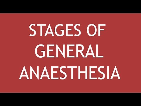 Stages Of General Anesthesia by Dr. Shikha Parmar