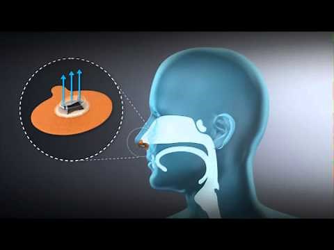 Getting Started with Provent Sleep Apnea Therapy
