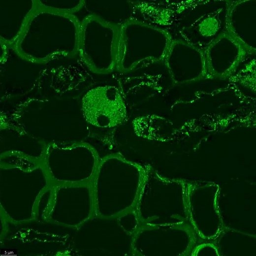 Sample video (Leica DMi8 Stellaris Confocal Laser Scanning Microscope)