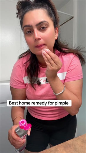 Best Home Remedy for Pimple: Simple Natural Treatment