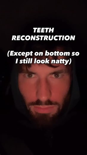 dTb on Instagram: "Put in work and start mogging #mog #surgery #looksmaxxing"