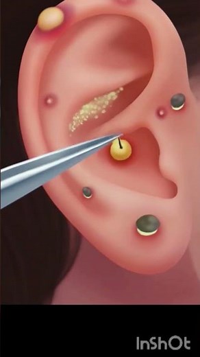 Ultra Relaxing ASMR Ear Cleaning | Deep & Gentle Ear Care for Sleep & Tingling Sensation