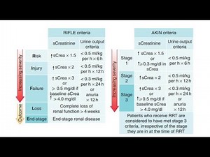 Classification of Acute kidney Injury based on Severity