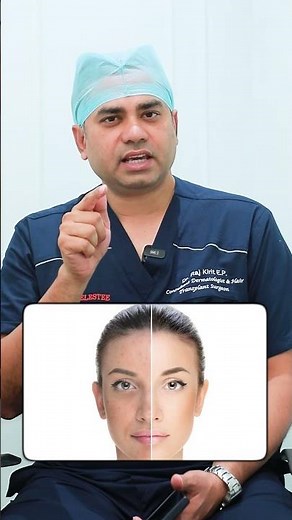 How to Repair Steroid Damaged Skin on Face |#ytshorts #healthtips #skincare #skinrecovery #facecream