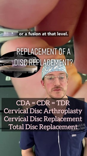 Are Disc Replacements Permanent? FAQs Answered by a Spine Specialist