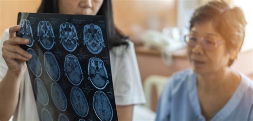 Women get Alzheimer’s more often than men: Five things the science tells us