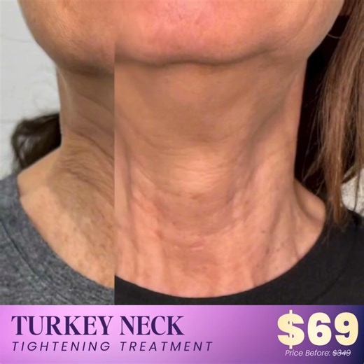 4 comments |  Overland Park Ladies! Ready to Tighten, Smooth & Lift...