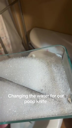 Proper Care for Your Poop Knife in Illinois