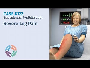 Educational Walkthrough Case #172: "Severe Leg Pain"