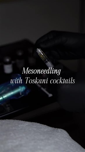 D&A Esthetics Medical Spa on Instagram: "ITS HERE! Mesoneedling is a minimally invasive skin rejuvenation treatment that combines two powerful techniques: ✨Nanoneedling: tiny, controlled micro-injuries to boost collagen and elastin production. ✨ Mesotherapy: customized serums (Toskani’s pharmaceutical grade formulas) are delivered deep into the skin to target specific concerns. The result? A treatment that works from the inside out to: - Smooth fine lines & wrinkles - Improve acne scars and text