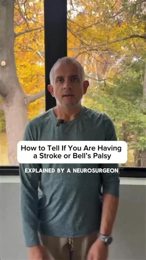 Bell’s Palsy vs Stroke — the difference every family should know As a neurosurgeon, I see how frightening sudden facial changes can be. Patients often arrive terrified, unsure whether they’re facing a stroke or Bell’s palsy — and that fear is completely understandable. In reality, these two conditions can look similar at first glance… but the patterns of symptoms tell a very different story. And recognizing those patterns early can change everything. I walk families through this distinction all 