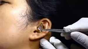 [Watch] Snake gets stuck inside woman's ear; netizens are shocked & disgusted