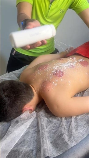 ASMR Back Massage | Cupping Therapy & Foam Body Wash🔥🙂#shorts