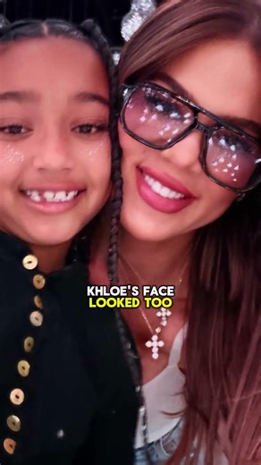 Khloé’s face was said to look different from the photo😱#KimKardashian #CelebrityDrama