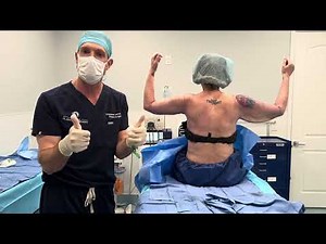 Dr. Hamwi’s Approach to Arm Lift Surgery: Sculpting, Shaping, and Achieving Balanced Results