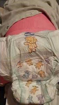 changing a spica cast nappy/diaper