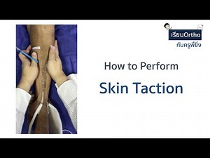 Skin Traction