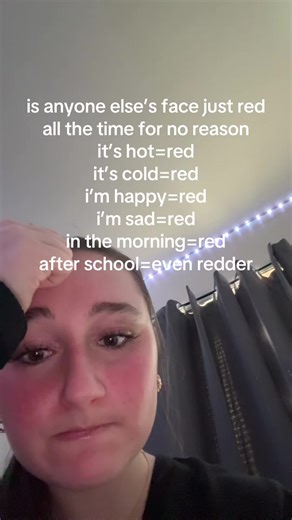 Why Is My Face Always Red? Relatable Moments