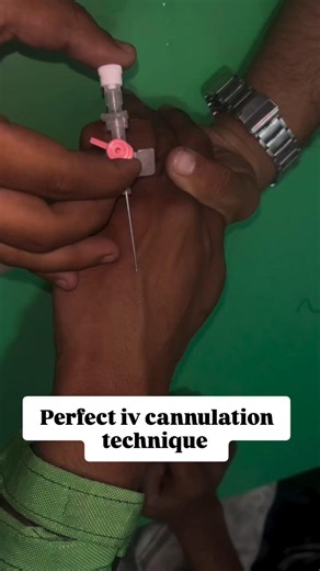 IV cannulation Technique | injection kaise lagate hain | medical videos | doctor #doctor #viral #yt